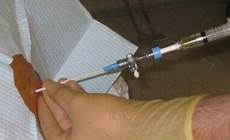 Medical Aspiration Equipment