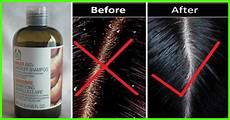 Medical Beauty Product