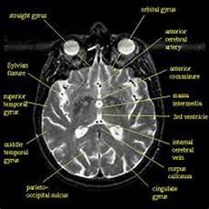 Medical Device Parts