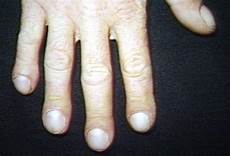 Medical Diagnosis