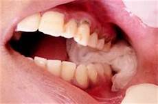 Medical Gauze