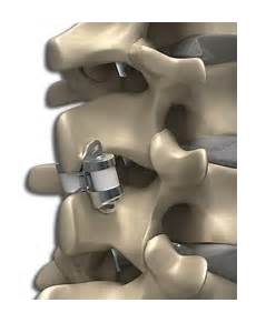 Medical Image Storage Devices