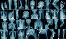 Medical Imaging