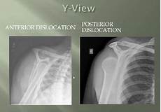 Medical Imaging
