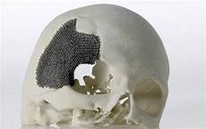Medical Implants