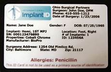 Medical Implants