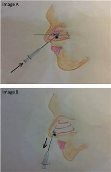 Medical Instrument