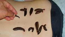 Medical Leech