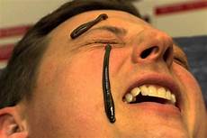 Medical Leech