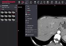 Medical Measuring Systems