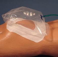 Medical Oxygen