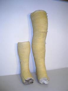Medical Splints