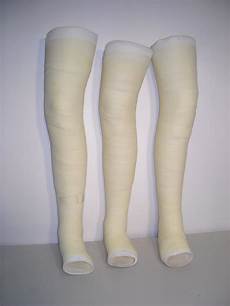 Medical Splints