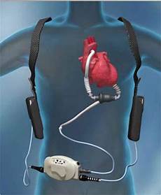 Medical Sterilization Devices
