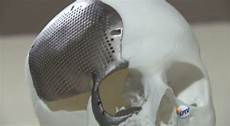 Medical Titanium