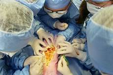 Medical Transfer