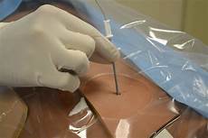 Medical Tube