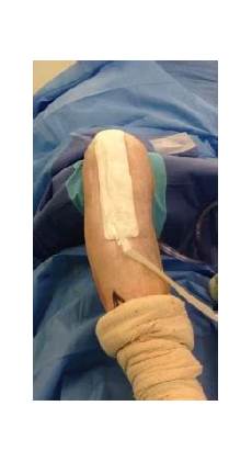 Medical Vacuum