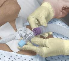 Medical Valves