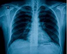 Medical X-Ray Films