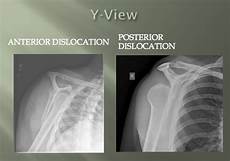 Medical X-Ray Films