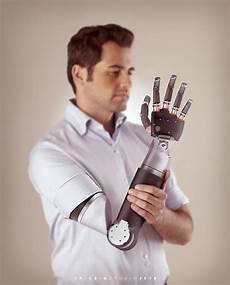 Prothesis Medical Peruke