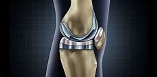 Prothesis Medical Peruke