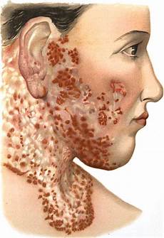 Skin And Medical Cream