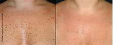 Skin And Medical Cream