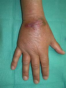 Skin And Medical Cream