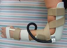 Splint