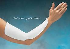 Splint