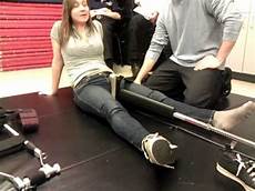 Splints