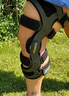 Splints