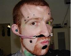 Stretchers